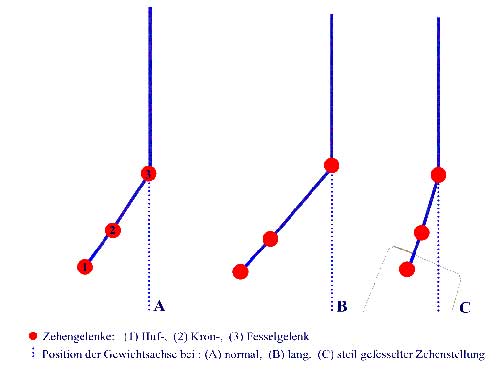 Zehenstellung2
